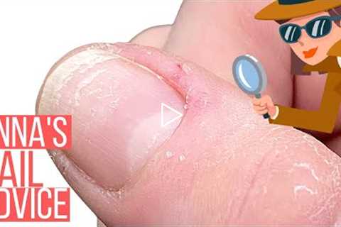 HORRIBLE CUTICLES? THINK AGAIN! This info will change everything! 🤯