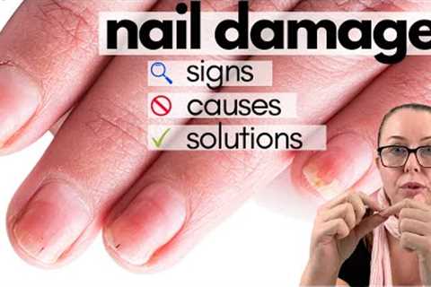 Damaged nails after acrylics, gels or dips? Your next steps  [Nail Professional Explains]